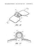 SECUREMENT DEVICE diagram and image