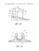 SECUREMENT DEVICE diagram and image