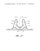 SECUREMENT DEVICE diagram and image