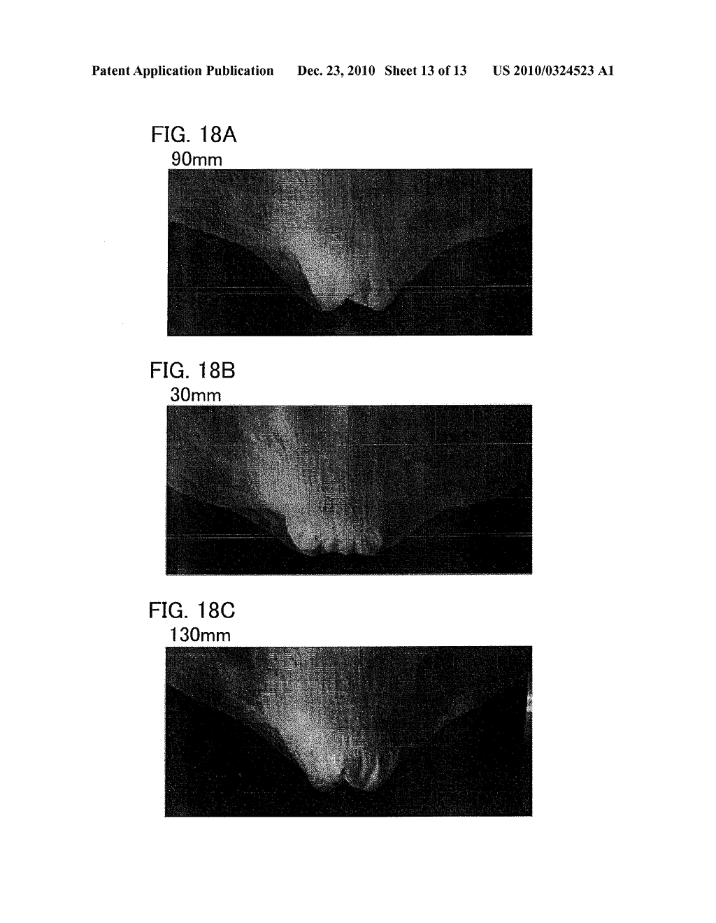 ABSORBENT ARTICLE - diagram, schematic, and image 14