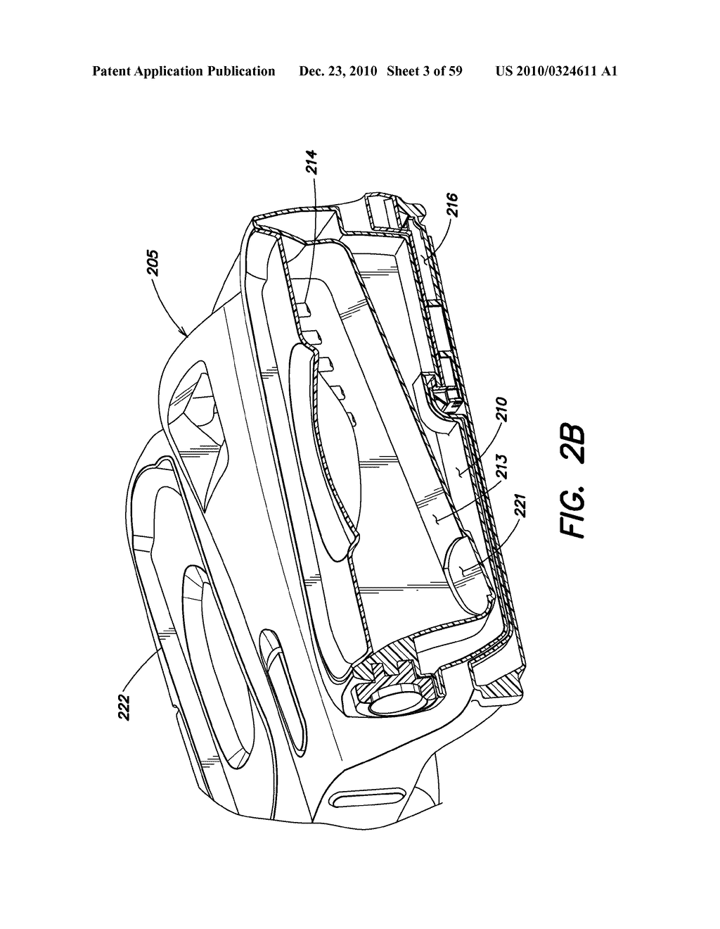 DEVICES, SYSTEMS AND METHODS FOR PREVENTING AND TREATING SENSATION LOSS - diagram, schematic, and image 04