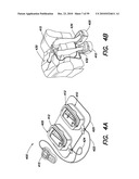 DEVICES, SYSTEMS AND METHODS FOR PREVENTING AND TREATING SENSATION LOSS diagram and image