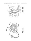 DEVICES, SYSTEMS AND METHODS FOR PREVENTING AND TREATING SENSATION LOSS diagram and image