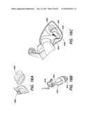 DEVICES, SYSTEMS AND METHODS FOR PREVENTING AND TREATING SENSATION LOSS diagram and image