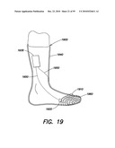 DEVICES, SYSTEMS AND METHODS FOR PREVENTING AND TREATING SENSATION LOSS diagram and image