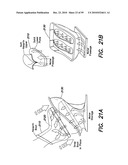 DEVICES, SYSTEMS AND METHODS FOR PREVENTING AND TREATING SENSATION LOSS diagram and image