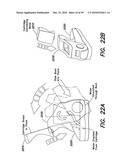 DEVICES, SYSTEMS AND METHODS FOR PREVENTING AND TREATING SENSATION LOSS diagram and image