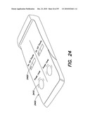 DEVICES, SYSTEMS AND METHODS FOR PREVENTING AND TREATING SENSATION LOSS diagram and image