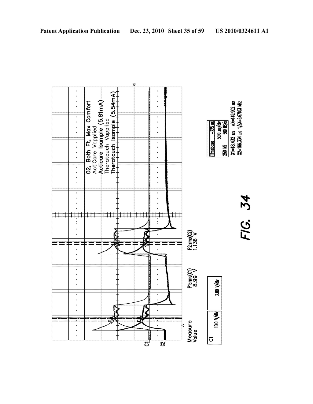 DEVICES, SYSTEMS AND METHODS FOR PREVENTING AND TREATING SENSATION LOSS - diagram, schematic, and image 36