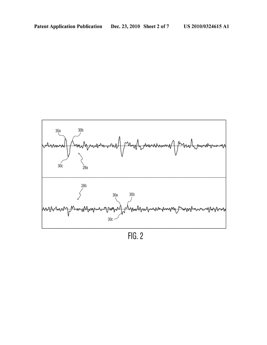 AURAL HEART MONITORING APPARATUS AND METHOD - diagram, schematic, and image 03