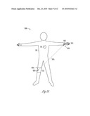 TRANSCUTANEOUS NEUROSTIMULATOR FOR MODULATING CARDIOVASCULAR FUNCTION diagram and image