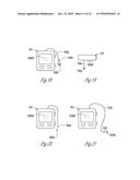 TRANSCUTANEOUS NEUROSTIMULATOR FOR MODULATING CARDIOVASCULAR FUNCTION diagram and image