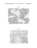 Method and portable system for non-invasive, In-vivo blood irradiation light therapy diagram and image