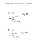 Method and portable system for non-invasive, In-vivo blood irradiation light therapy diagram and image