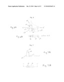 Method and portable system for non-invasive, In-vivo blood irradiation light therapy diagram and image