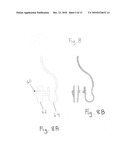 Method and portable system for non-invasive, In-vivo blood irradiation light therapy diagram and image