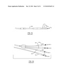 METHODOLOGY AND APPARATUS TO TERMINATE ABANDONED ACTIVE IMPLANTABLE MEDICAL DEVICE LEADS diagram and image