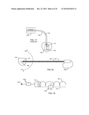 METHODOLOGY AND APPARATUS TO TERMINATE ABANDONED ACTIVE IMPLANTABLE MEDICAL DEVICE LEADS diagram and image