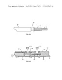 METHODOLOGY AND APPARATUS TO TERMINATE ABANDONED ACTIVE IMPLANTABLE MEDICAL DEVICE LEADS diagram and image