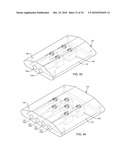 METHODOLOGY AND APPARATUS TO TERMINATE ABANDONED ACTIVE IMPLANTABLE MEDICAL DEVICE LEADS diagram and image