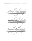 METHODOLOGY AND APPARATUS TO TERMINATE ABANDONED ACTIVE IMPLANTABLE MEDICAL DEVICE LEADS diagram and image