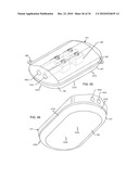 METHODOLOGY AND APPARATUS TO TERMINATE ABANDONED ACTIVE IMPLANTABLE MEDICAL DEVICE LEADS diagram and image