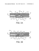 NOVEL FEATURES FOR ROUTING CONDUCTORS IN MEDICAL ELECTRICAL LEAD ELECTRODE ASSEMBLIES diagram and image