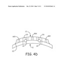 NOVEL FEATURES FOR ROUTING CONDUCTORS IN MEDICAL ELECTRICAL LEAD ELECTRODE ASSEMBLIES diagram and image