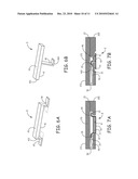 NOVEL FEATURES FOR ROUTING CONDUCTORS IN MEDICAL ELECTRICAL LEAD ELECTRODE ASSEMBLIES diagram and image