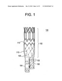 STENT-GRAFT SECUREMENT DEVICE diagram and image