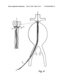 Device and method for treating ruptured aneurysms diagram and image