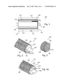 Knitted Stent Jackets diagram and image