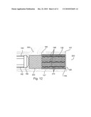 Knitted Stent Jackets diagram and image