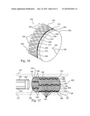 Knitted Stent Jackets diagram and image