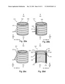 Knitted Stent Jackets diagram and image