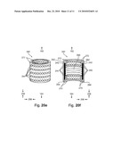 Knitted Stent Jackets diagram and image