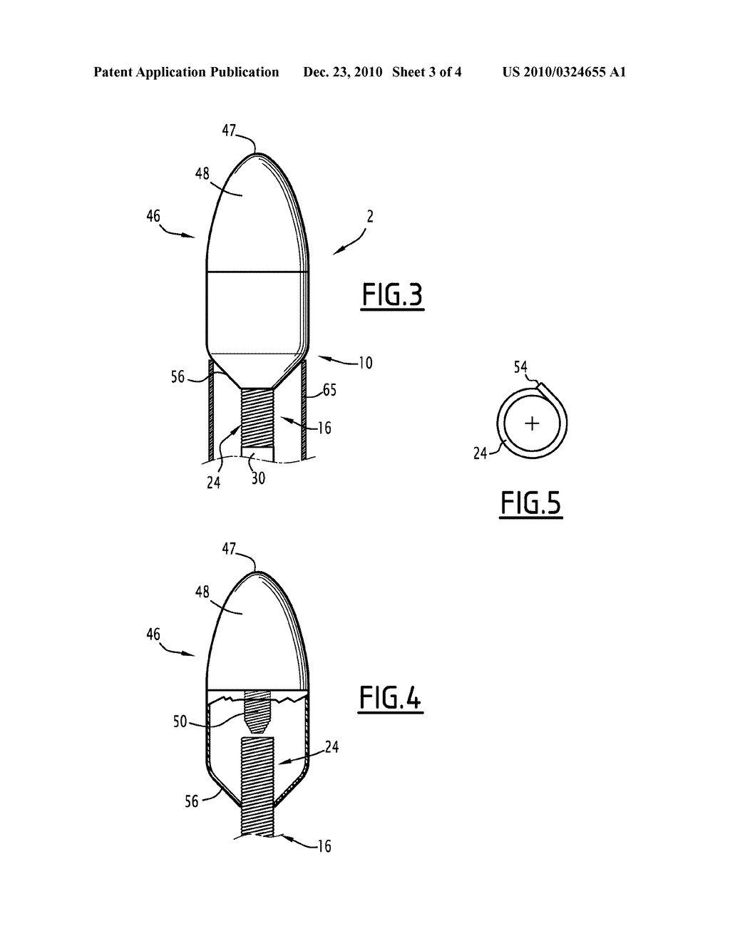 TREATMENT DEVICE FOR A BLOOD CIRCULATION VESSEL - diagram, schematic, and image 04