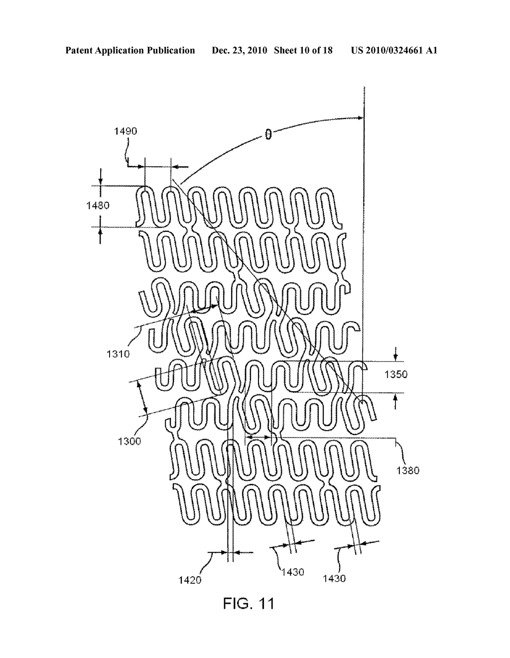 STENT HAVING HELICAL ELEMENTS - diagram, schematic, and image 11