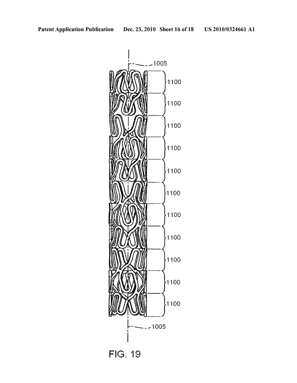 STENT HAVING HELICAL ELEMENTS - diagram, schematic, and image 17