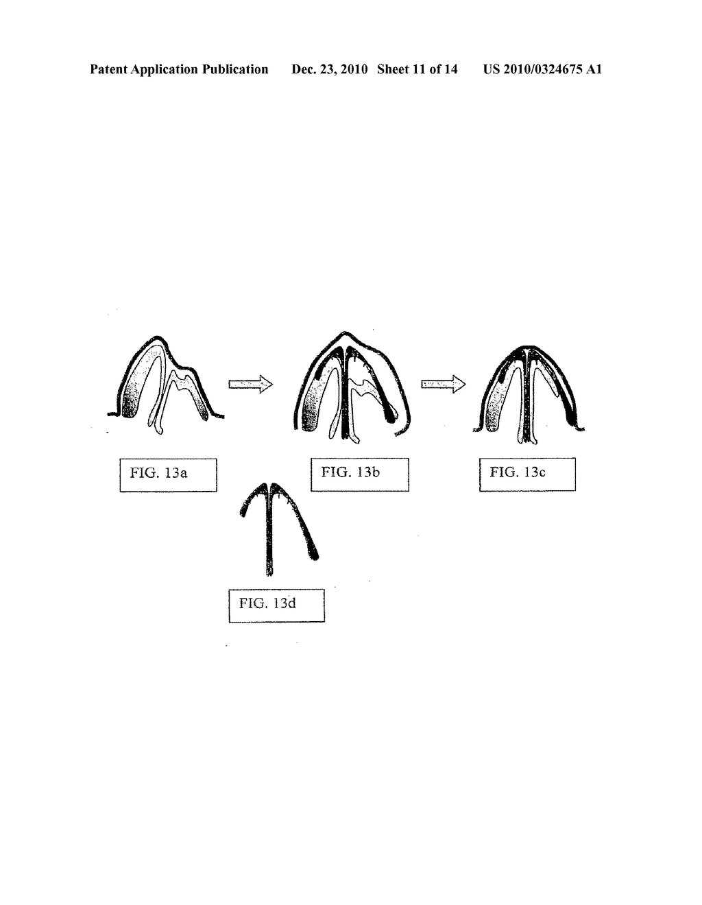 SURGICAL SCAFFOLD - diagram, schematic, and image 12