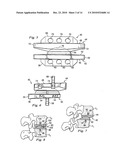 Spinal Prosthetic Joints diagram and image