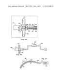 Spinal Prosthetic Joints diagram and image