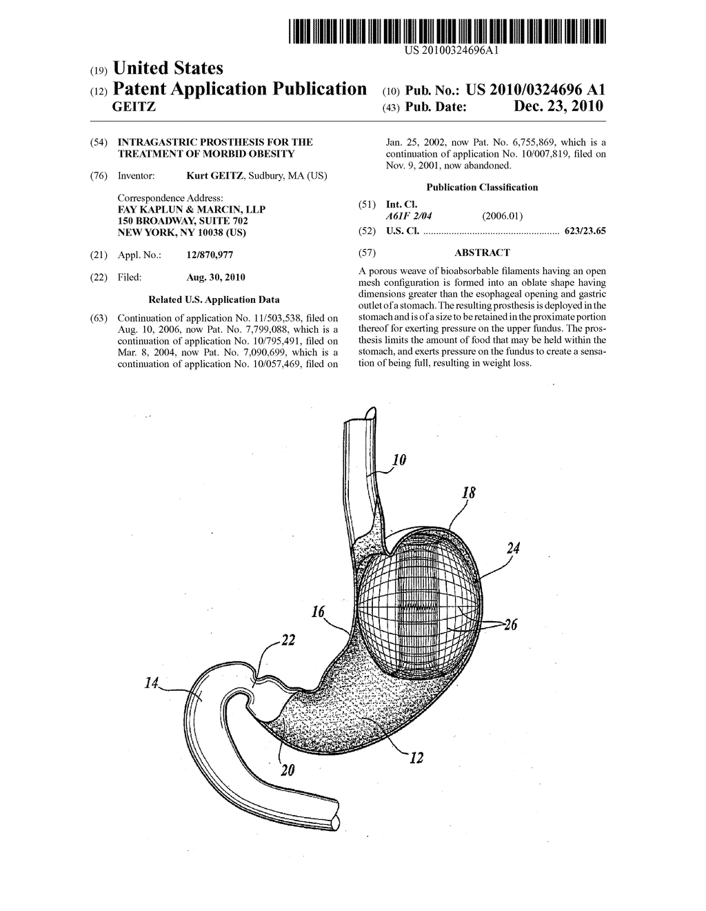 Intragastric Prosthesis for the Treatment of Morbid Obesity - diagram, schematic, and image 01