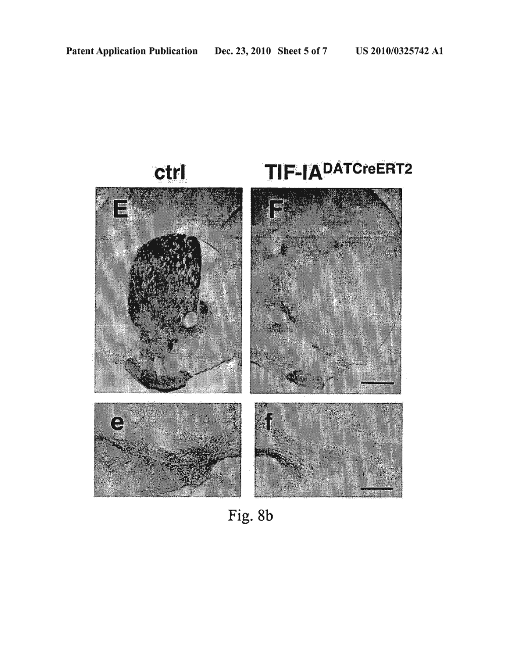 Animal Model Based on Targeted Apoptosis for the Study of Genetic Diseases Such as Parkinson's Disease - diagram, schematic, and image 06