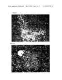 METHOD OF EXPANDING HUMAN HEPATOCYTES IN VIVO diagram and image