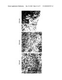 METHOD OF EXPANDING HUMAN HEPATOCYTES IN VIVO diagram and image