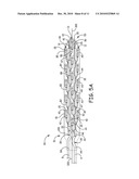 NOVEL ASSEMBLY METHODS FOR MEDICAL ELECTRICAL LEADS diagram and image