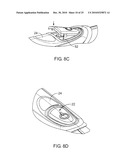 Razors diagram and image