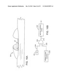 Razors diagram and image