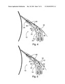 Method, a Blade Holder and a Doctor Apparatus for Detaching a Web Threading Tail From a Moving Surface in a Fiber Web Machine diagram and image